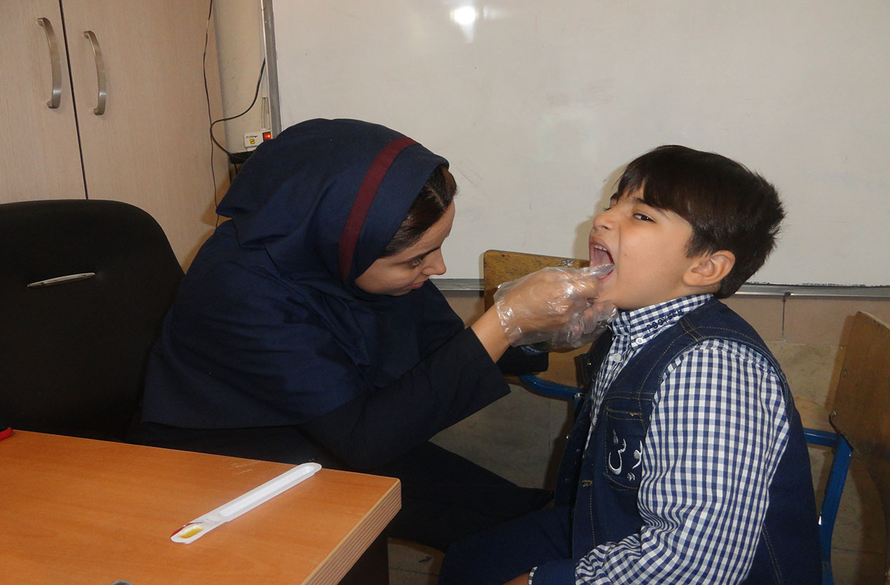 انجام وارنیش فلوراید دندان های دانش آموزان 